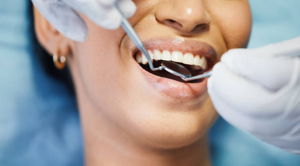 Best Emergency Treatment for Oral Infections in Lely, FL